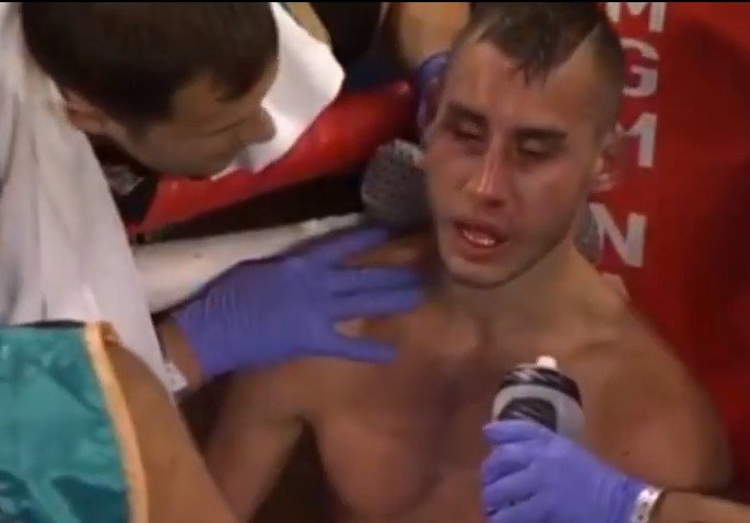 Российский боксер впал в кому после тяжелейшей операции на черепе